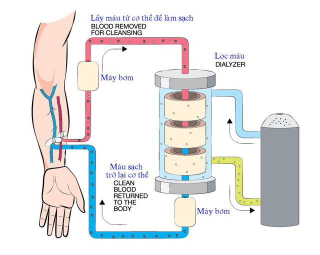 Nguy cơ chạy thận nhân tạo do ăn uống - Ảnh 1.