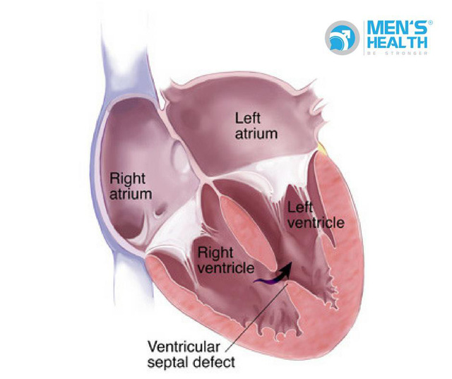 Biểu hiện thường gặp ở trẻ bị bệnh tim bẩm sinh và cách điều trị. - Ảnh 1.