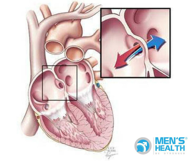 Biểu hiện thường gặp ở trẻ bị bệnh tim bẩm sinh và cách điều trị. - Ảnh 2.