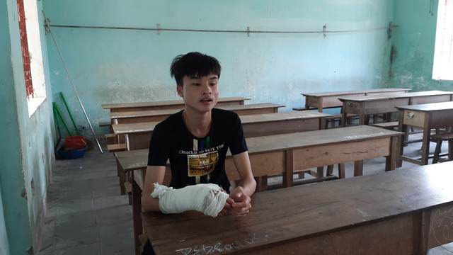 Gãy tay, thí sinh vẫn phải tự làm bài thi - Ảnh 1.
