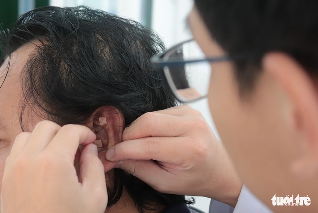 TP.HCM có nơi đầu tiên cai nghiện thuốc lá thành công bằng châm cứu, bấm huyệt - Ảnh 1.