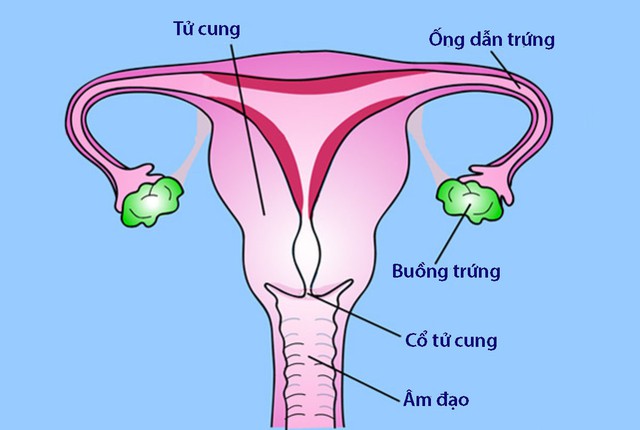 Viêm vùng chậu ở phụ nữ - Ảnh 1.