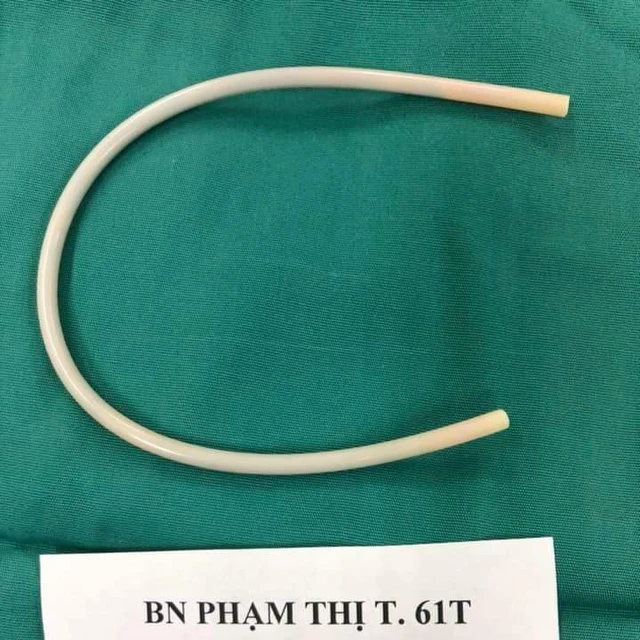 Clip lấy ống nhựa cứng dài 30cm trong khung chậu nữ bệnh nhân - Ảnh 1.