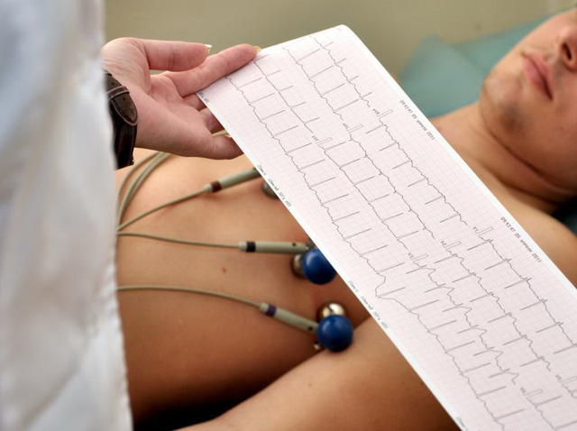 Điện tâm đồ (ECG) - Ảnh 1.