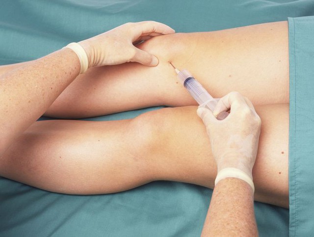 Tiêm khớp gối là phương pháp được sử dụng phổ biến hiện nay