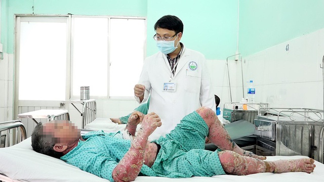 Bôi thuốc dân tộc vô, toàn thân sưng vù, nứt da, đóng vảy... - Ảnh 1.