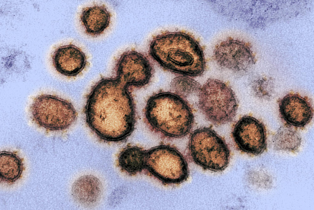 Đại dịch COVID-19 tái hiện đại dịch cúm 1918 - Ảnh 1.