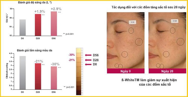 Chuyên gia Pháp bật mí công nghệ chống nám trong Beta White hướng đích - Ảnh 3.