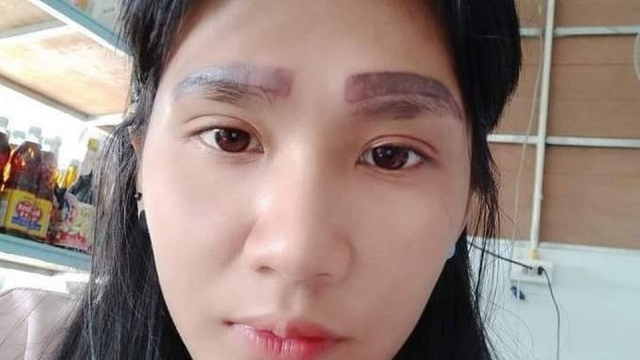 Cô gái sở hữu 2 cặp lông mày sau khi đi thẩm mỹ - Ảnh 1.