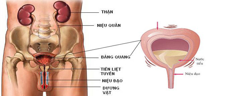 Không vô nhà vệ sinh kịp thì són tiểu là bệnh gì?