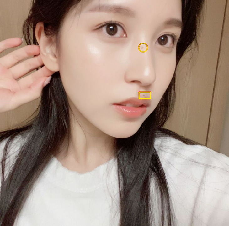 Mina (Twice) tiết lộ về "nốt ruồi thương hiệu" từng bị ép tẩy bỏ