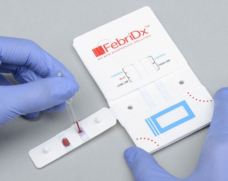 Xét nghiệm FebriDx: Giúp giảm vấn nạn siêu vi khuẩn kháng thuốc - Ảnh 1.