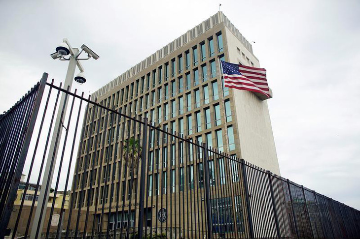 Mỹ phát hiện bất thường trong não nhân viên ngoại giao ở Cuba - Ảnh 1.