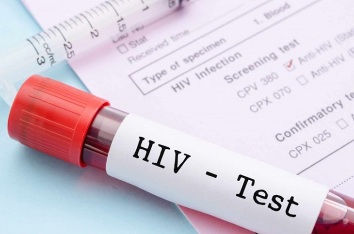 Xét nghiệm HIV sớm: Tiền đề để đạt mục tiêu 90-90-90 - Ảnh 1.