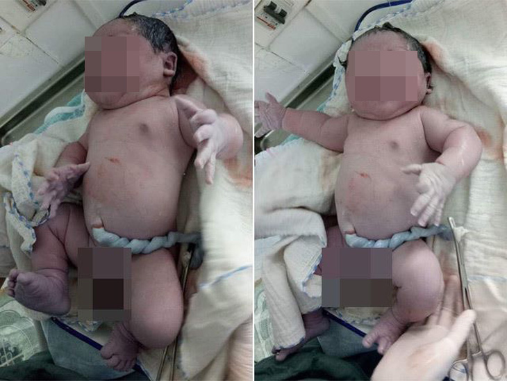 Kỷ lục: em bé sơ sinh nặng 7,1 kg - Ảnh 1.