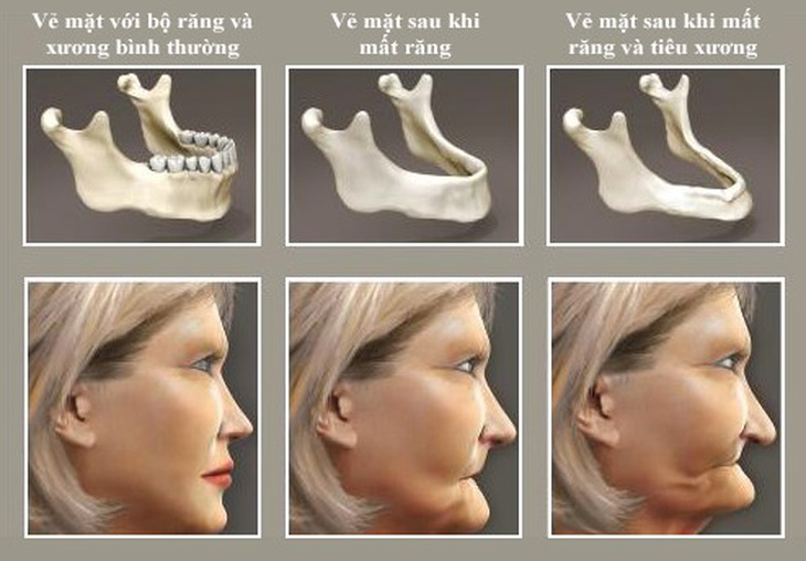 Điều kỳ diệu, răng đã mất “mọc lại” chỉ 4 tuần - Ảnh 1.