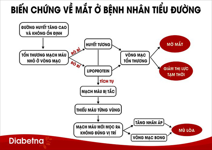 4 cách đơn giản giảm nguy cơ mù lòa ở bệnh nhân tiểu đường - Ảnh 1.