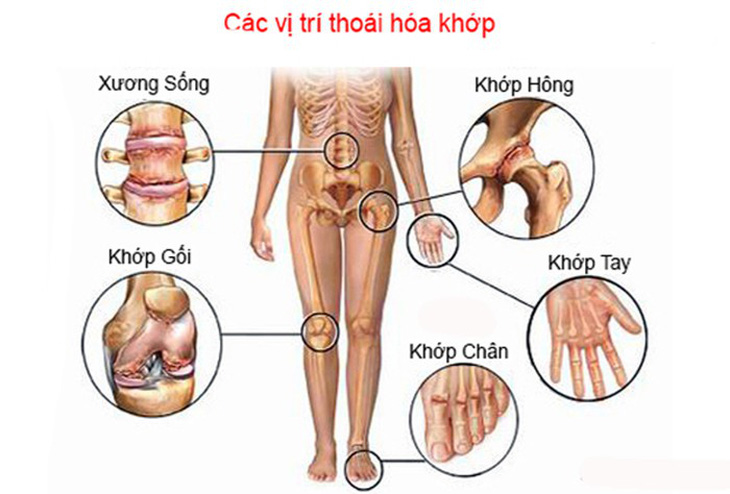 Thuốc điều trị, hỗ trợ trong bệnh lý về khớp - Ảnh 1.