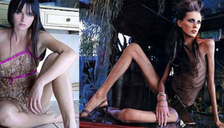 Siêu ốm như Kate Moss vẫn lên bìa British Vogue 34 lần - Ảnh 1.