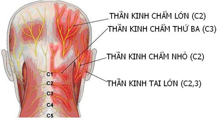 Đau dây thần kinh chẩm - Ảnh 1.