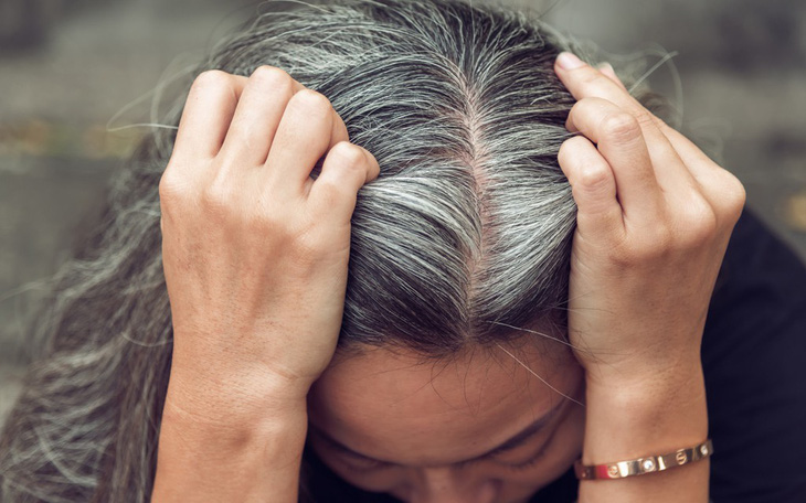 Bệnh tóc bạc sớm: Nguyên nhân và cách điều trị