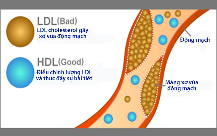 Phân biệt mỡ máu tốt và xấu - Ảnh 1.