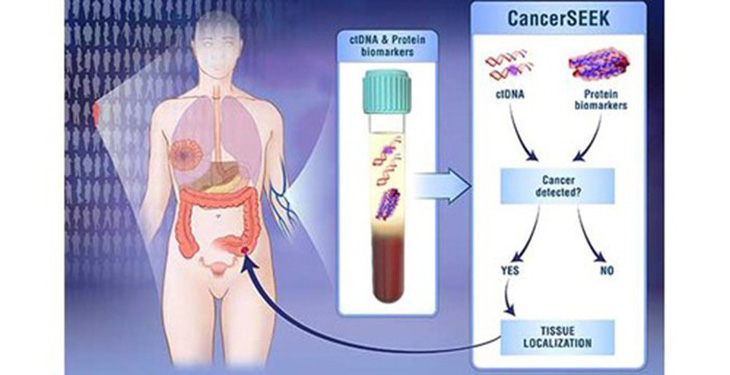 Tìm ra phương pháp mới: Thử máu phát hiện ung thư - Ảnh 1.
