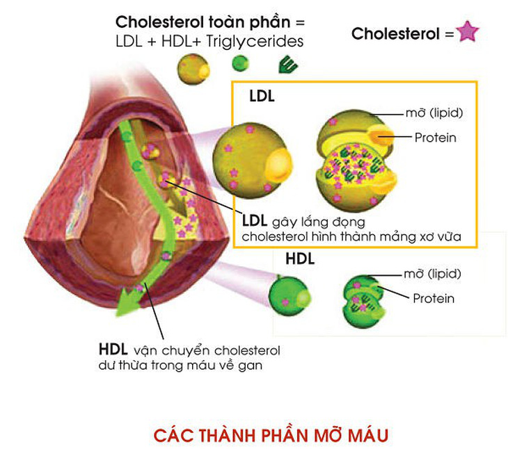 Các loại thành phần chính của lipid máu - Ảnh 1.