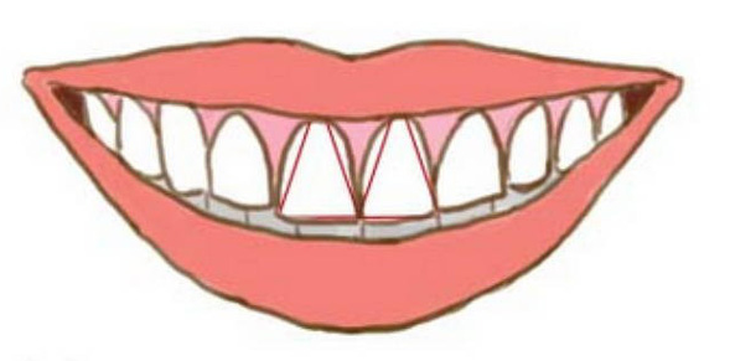 Nhìn răng biết tính cách? - Ảnh 4.