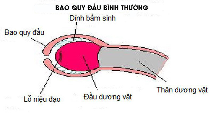 Đừng đưa bé đi nong bao quy đầu quá sớm! - Ảnh 1.