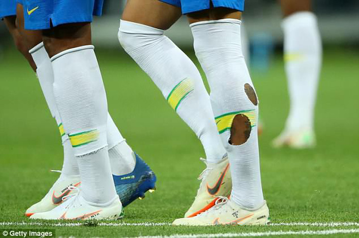 Vì sao Neymar mang vớ rách thi đấu tại World Cup? - Ảnh 2.