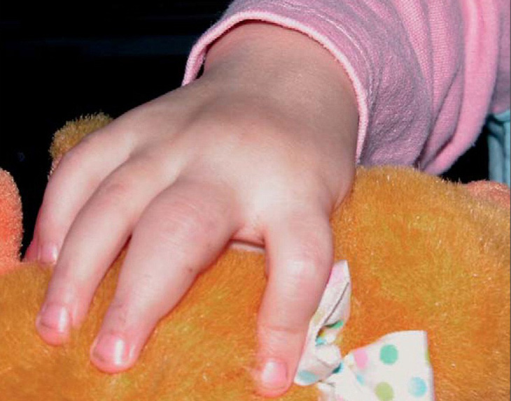 Bệnh xương khớp có thể gặp ở cả trẻ em và người lớn - Ảnh 1.