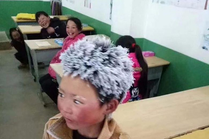 Bé trai Trung Quốc bị đóng băng tóc được tặng 2,6 triệu USD - Ảnh 2.