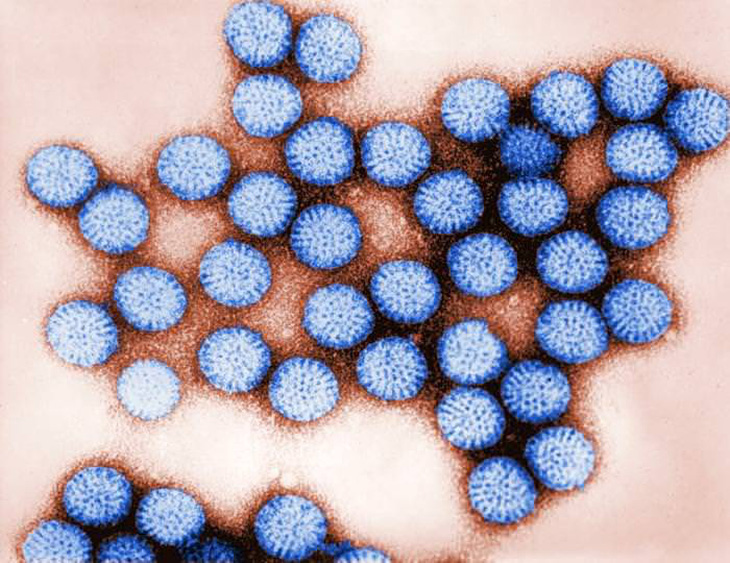 Viêm dạ dày-ruột do rotavirus - Ảnh 1.