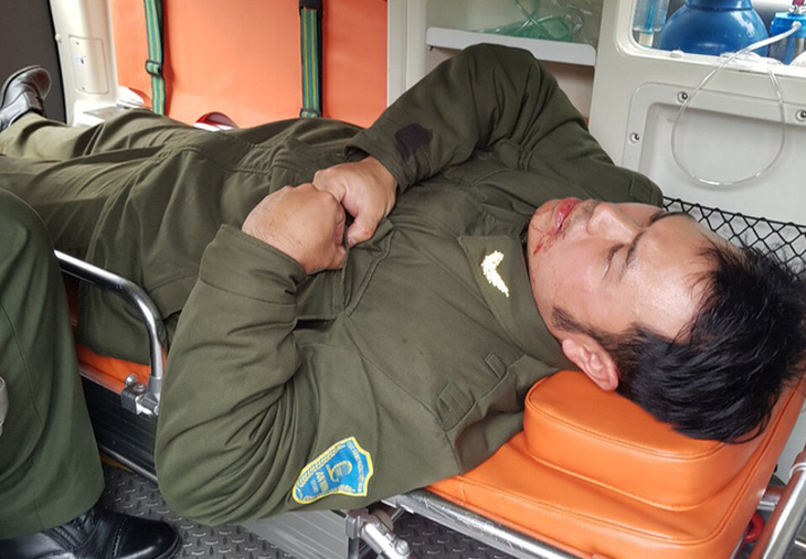 Nhân viên an ninh sân bay Nội Bài bị đánh gãy 4 răng - Ảnh 1.