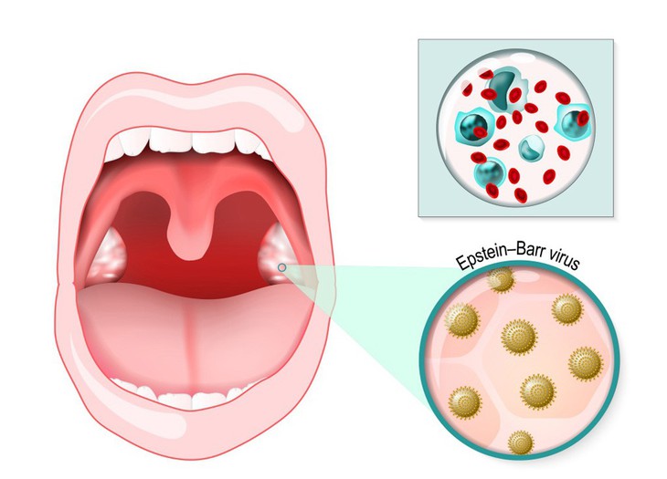 Căn bệnh của những nụ hôn - Ảnh 1.