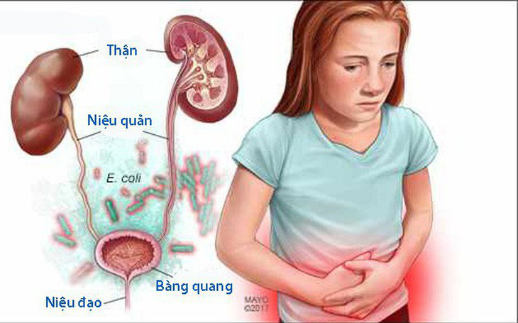 Chăm sóc trẻ bị nhiễm khuẩn tiết niệu