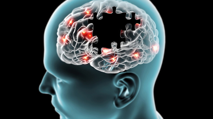 Hàn Quốc phát triển công nghệ chẩn đoán giảm trí nhớ nhờ xét nghiệm - Ảnh 1.