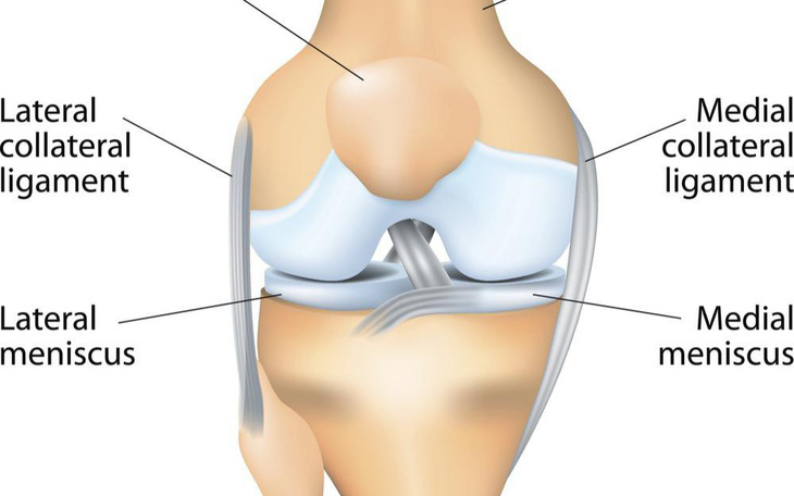 Điều trị thoái hóa khớp gối - Kỳ 1: Bảy nguyên nhân đau đớn