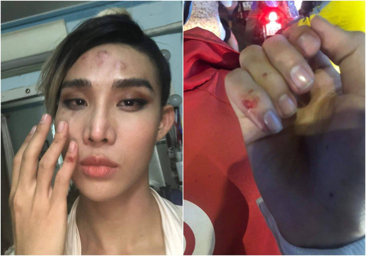 Người mẫu The Face tố bị tài xế Go Viet đánh vào mặt và bóp cổ - Ảnh 1.