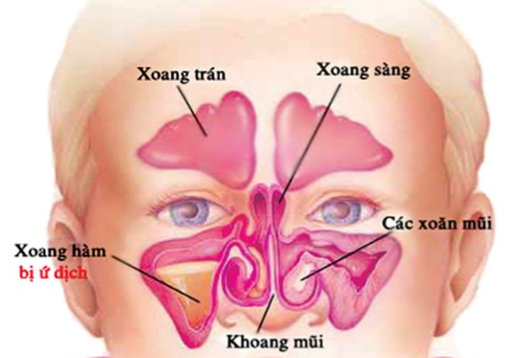 Khẩu trang bình thường có chống bụi mịn được không?  - Ảnh 2.