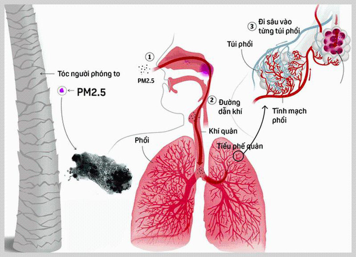 Tác hại khôn lường từ ô nhiễm không khí đến sức khỏe - Ảnh 2.