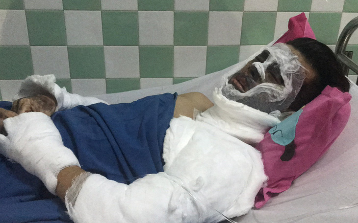 Việt kiều bị tạt axit rồi cắt gân chân: 