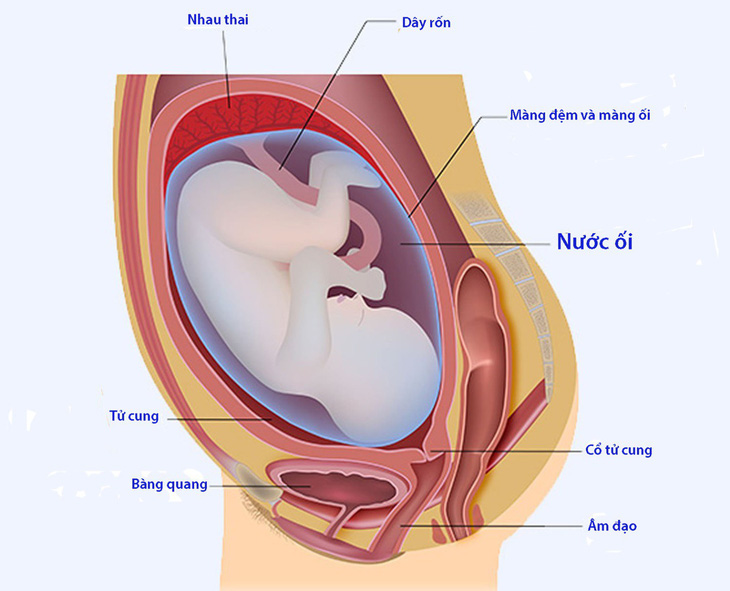 Khi mang thai bị rỉ ối - Ảnh 1.