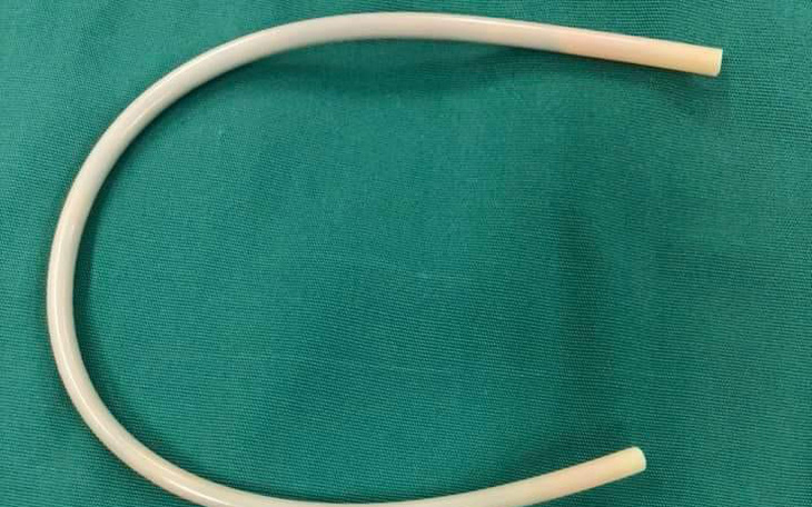 Clip lấy ống nhựa cứng dài 30cm trong khung chậu nữ bệnh nhân