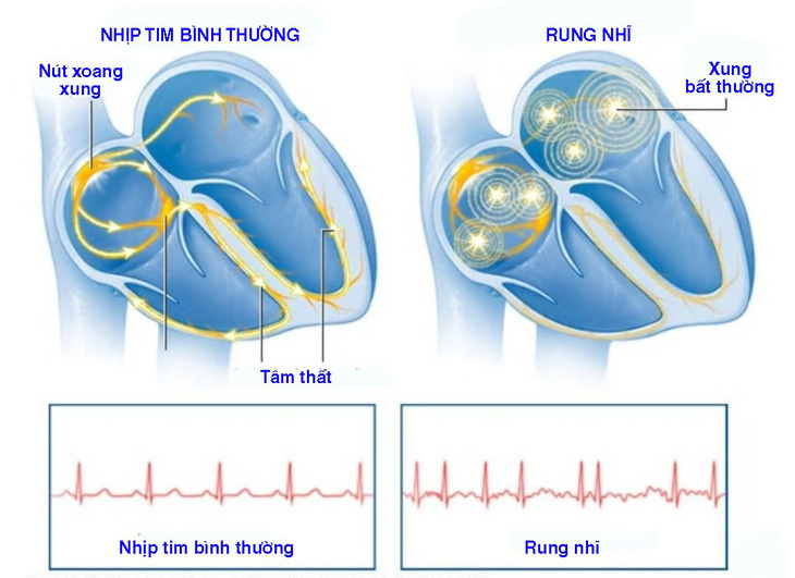 Hồi hộp - Ảnh 1.