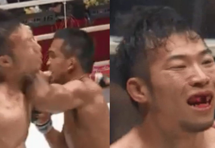 Võ sĩ MMA Nhật bị đối thủ Thái Lan đánh văng răng cửa - Ảnh 1.