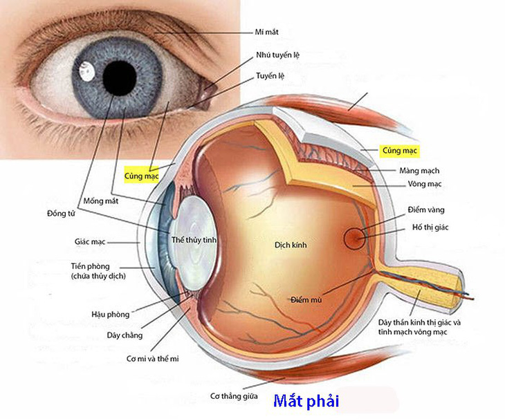 Viêm củng mạc - Ảnh 1.