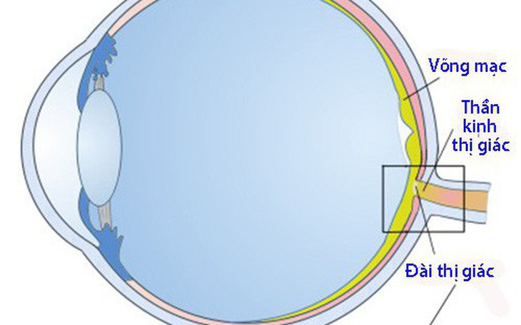 Teo dây thần kinh thị giác: Bệnh thường gặp ở người lớn tuổi
