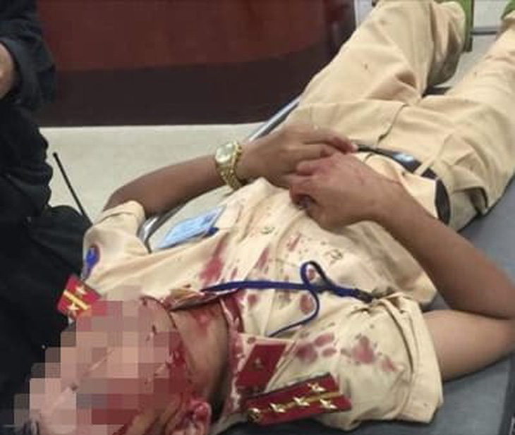 Một đại úy CSGT bị người vi phạm đập đá vào đầu nhập viện - Ảnh 1.